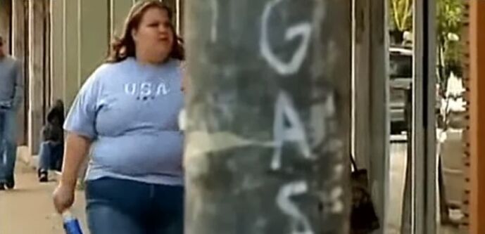 Overweight - the cause of varicose veins