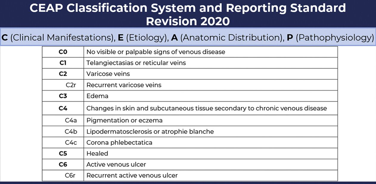 Stages of varicose veins according to the CEAP classification changed in 2020